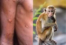 monkeypox disease