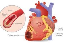 Heart Attack Risk Rising in Youth: Know the main causes